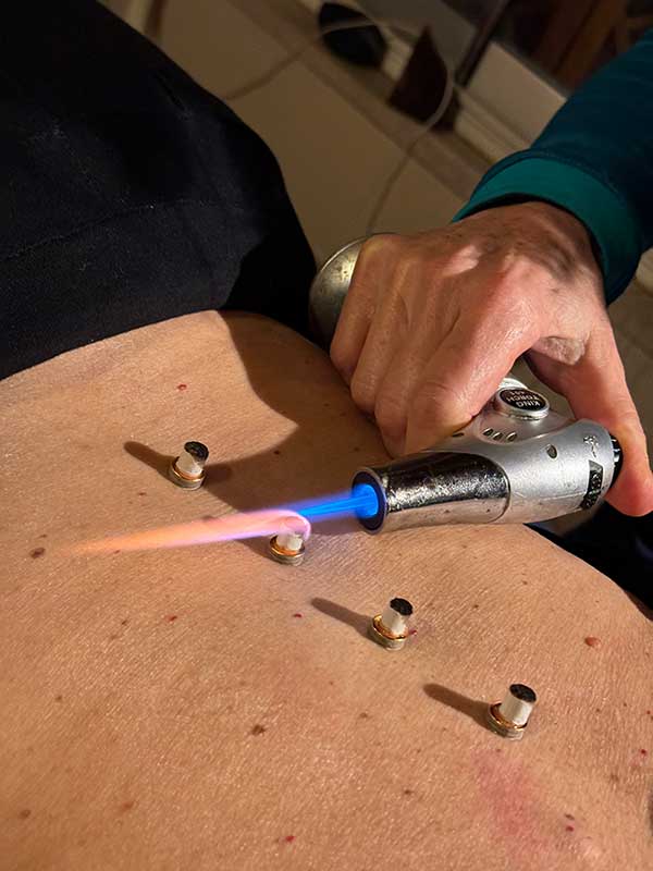 Dott.ssa Federica Bacecci - Moxa -Pontedera